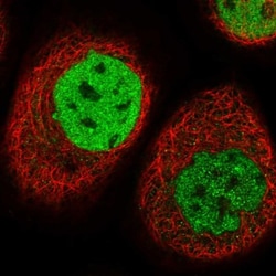 TESK2 Antibody, Novus Biologicals 25 &mu;L; Unlabeled:Antibodies, Polyclonal